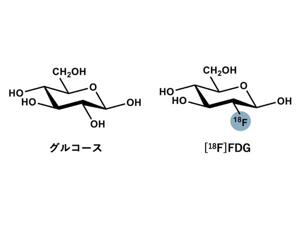 glucose FDG.jpg